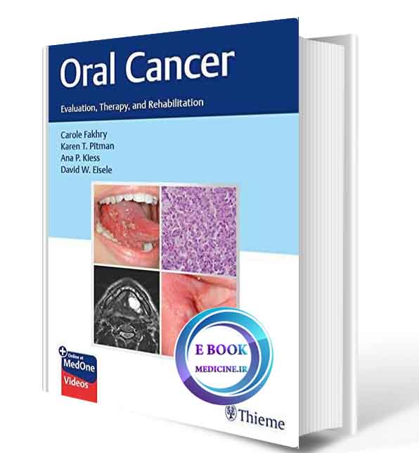 دانلود کتاب Oral Cancer Evaluation, Therapy, and Rehabilitation 2020(ORIGINAL PDF)